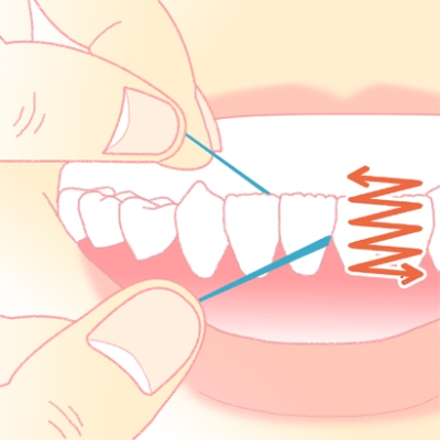 デンタルフロスを歯間に差し込み、ギザギザと前後させる