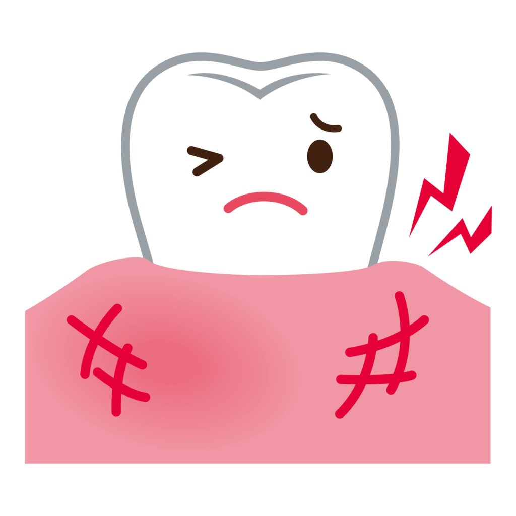 かゆい時の歯茎はデリケート