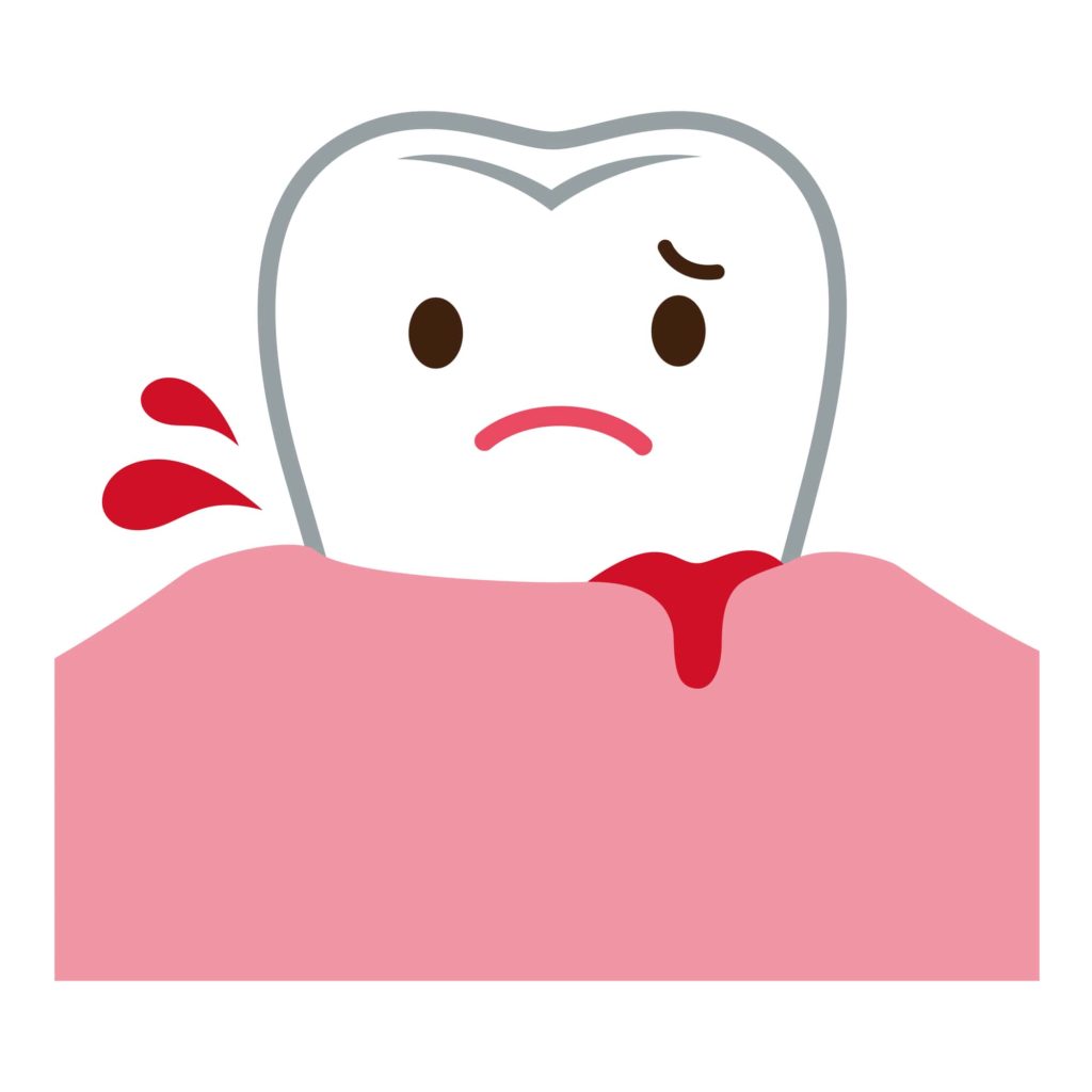 歯間ブラシで血が出ても大丈夫？| 歯茎が傷つくのは磨く強さや選び方が原因