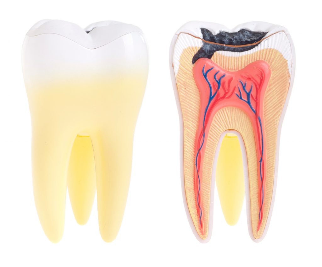 歯のエナメル質の5つの修復方法と傷つけない歯みがきのポイント